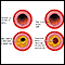 Developmental process of atherosclerosis