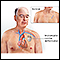 Implantable cardiac defibrillator